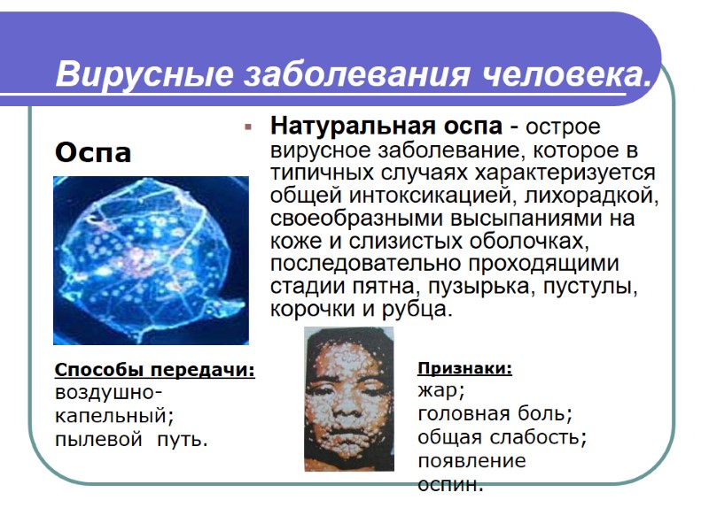 Вирусные заболевания человека.  Натуральная оспа - острое вирусное заболевание, которое в типичных случаях
